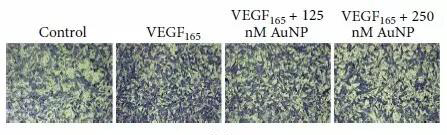 迁移4.png 迁移4.png